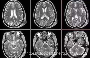 b超用的是超声波的什么原理_超声波洗牙原理是什么