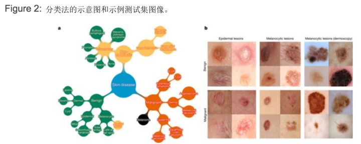 来自“自然”杂志：皮肤病学家对皮肤癌的深层神经网络分类