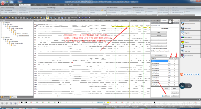 BP_Analyzer_完整笔记_bp analyzer-CSDN博客