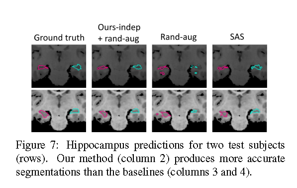 Data augmentation using learned transformations for one-shot medical image segmentation-论文详解