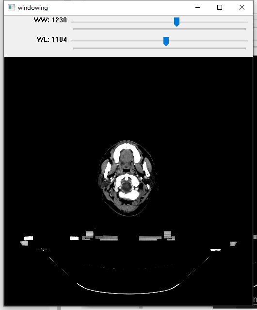 opencv使用滑条选择最佳加窗值（windowing:WW, WL）