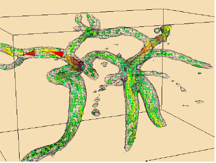 vtk可视化技术之人类颈动脉血管流动visualizingbloodflow