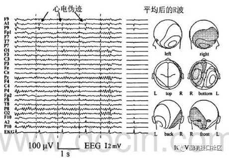 脑电波是什么存在原理_幸福是什么图片