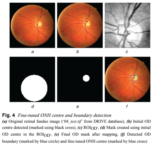 automaticdetectionandsegmentationofopticdiscandfoveainretinal