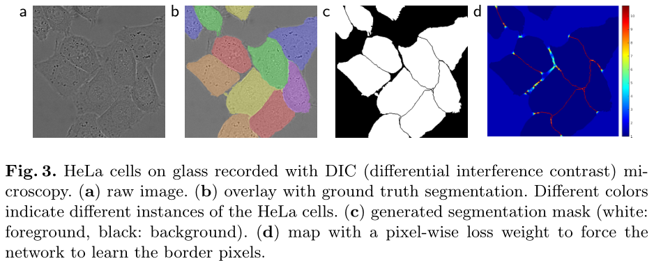 Unet论文详解U-Net:Convolutional Networks For Biomedical Image Segmentation