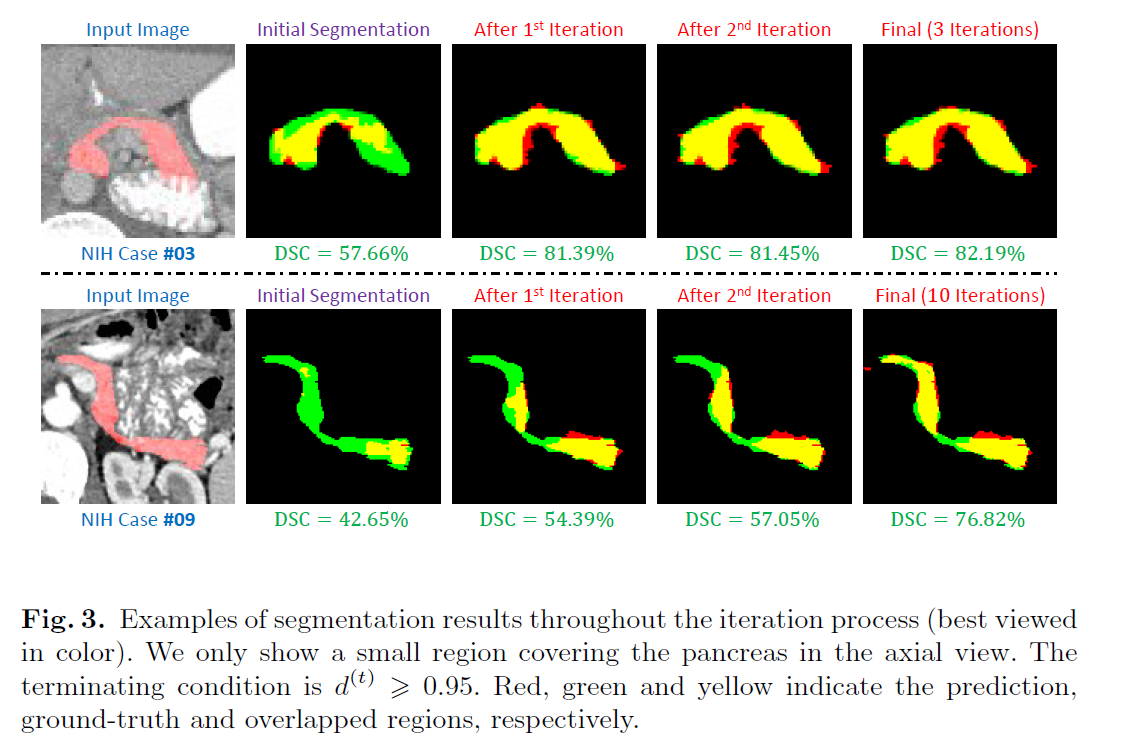 笔记-A Fixed-Point Model for Pancreas seg (MICCAI 2017)