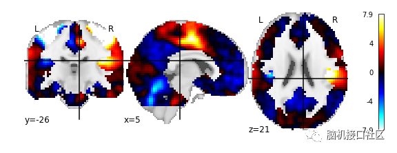 Nilearn教程系列(2)-3D和4D niimgs:处理和可视化_nilearn处理4d数据-CSDN博客