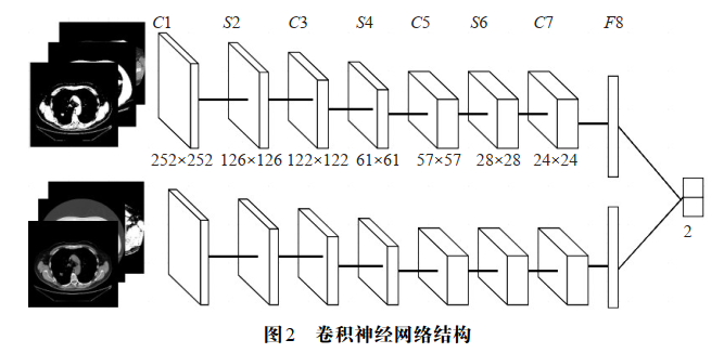 基于卷积神经网络的肺结节分类算法