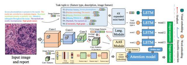 MDNet：影像通过 CNN 生成特征后接入 AAS 模块，最后通过 LSTM 生成诊断报告