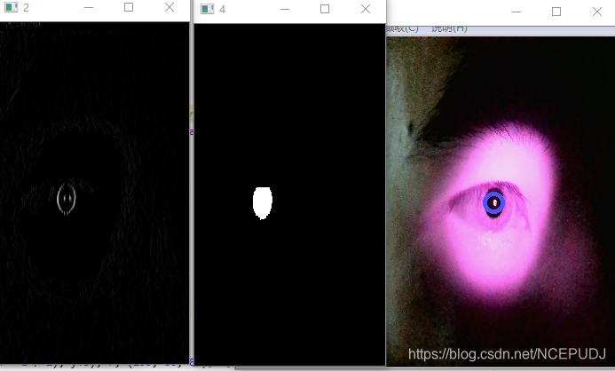 基于OpenCV处理的瞳孔定位效果图