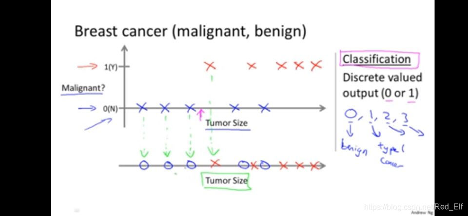 breast cancer prediction