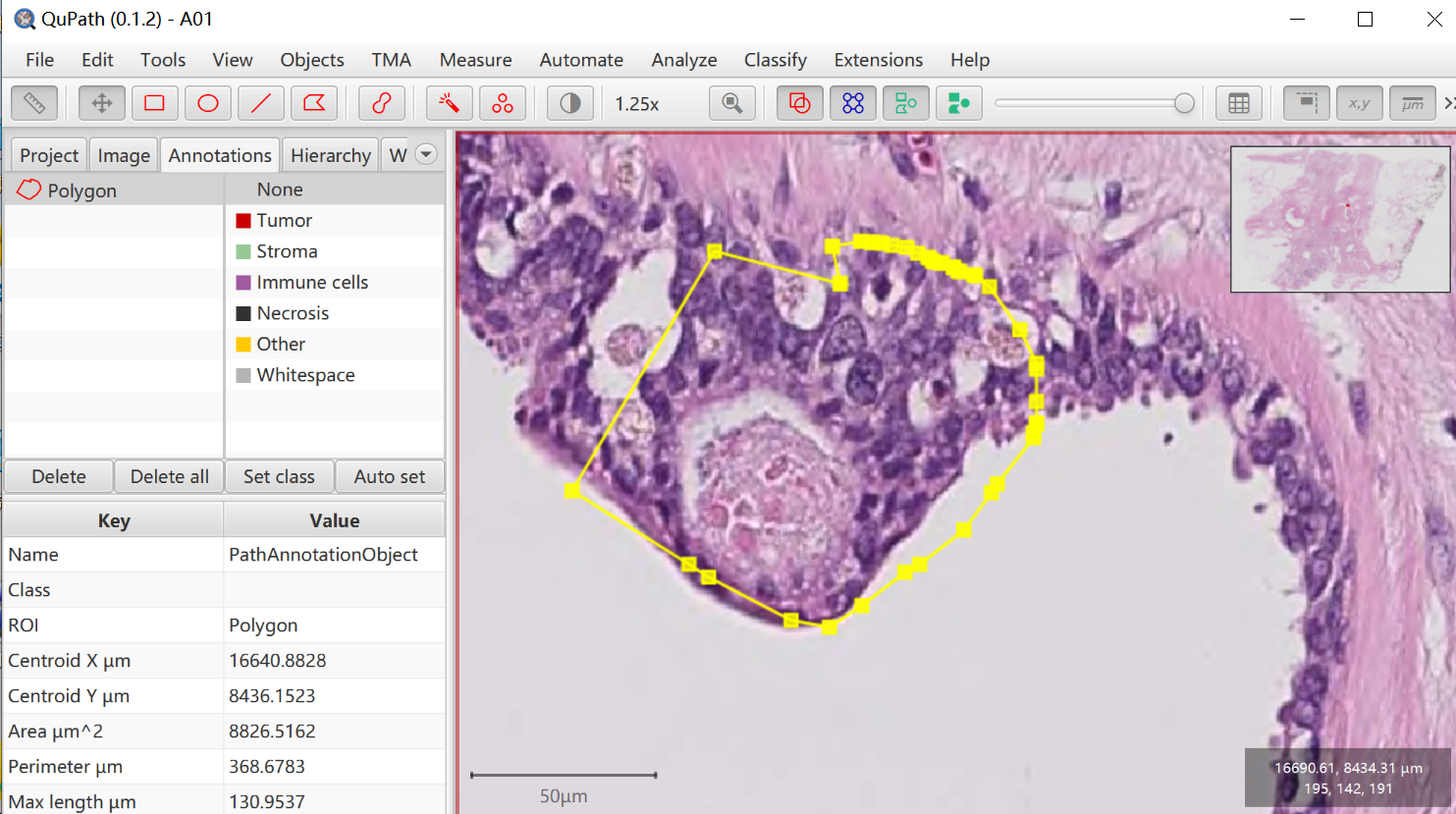 Qupath软件的安装与使用-CSDN博客