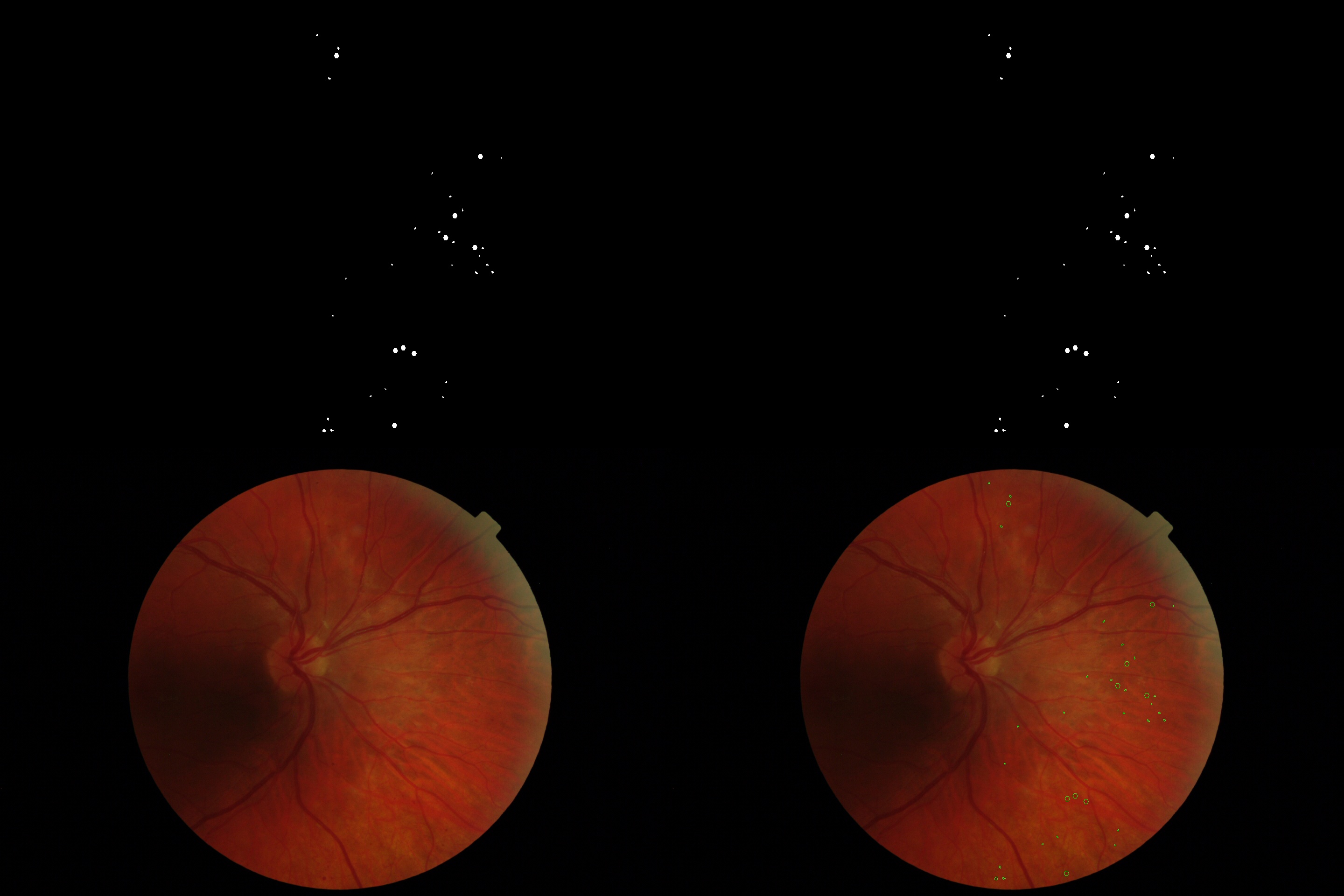 e_ophtha_ma眼底数据集—根据微血管瘤标注mask绘制contour轮廓图