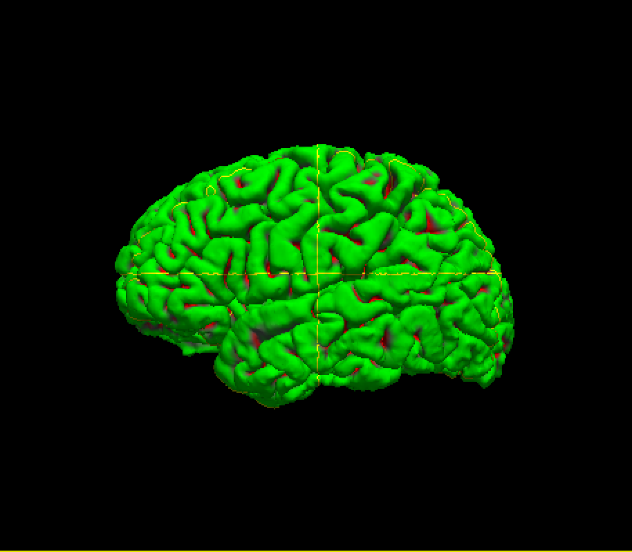 Freesurfer学习笔记——Introduction to Freesurfer Output(输出简介)_freesurfer 输出文件 ...