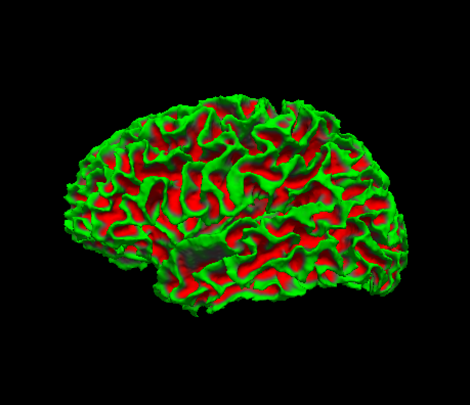 Freesurfer学习笔记——Introduction to Freesurfer Output(输出简介)_freesurfer 输出文件 ...