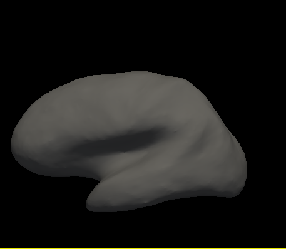 Freesurfer学习笔记——Introduction to Freesurfer Output(输出简介)_freesurfer 输出文件 ...