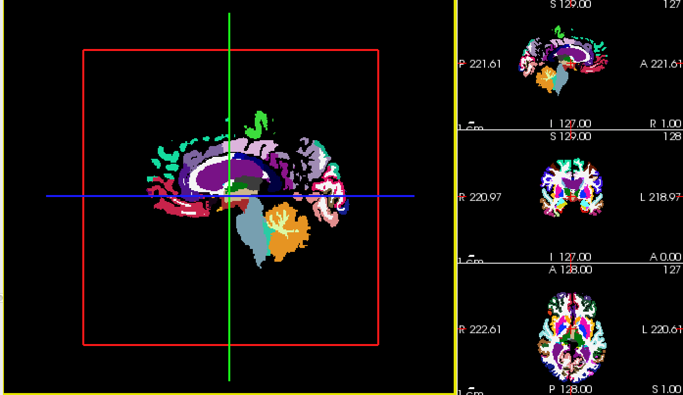Freesurfer学习笔记——Introduction to Freesurfer Output(输出简介)-练习题_aparc和aseg ...