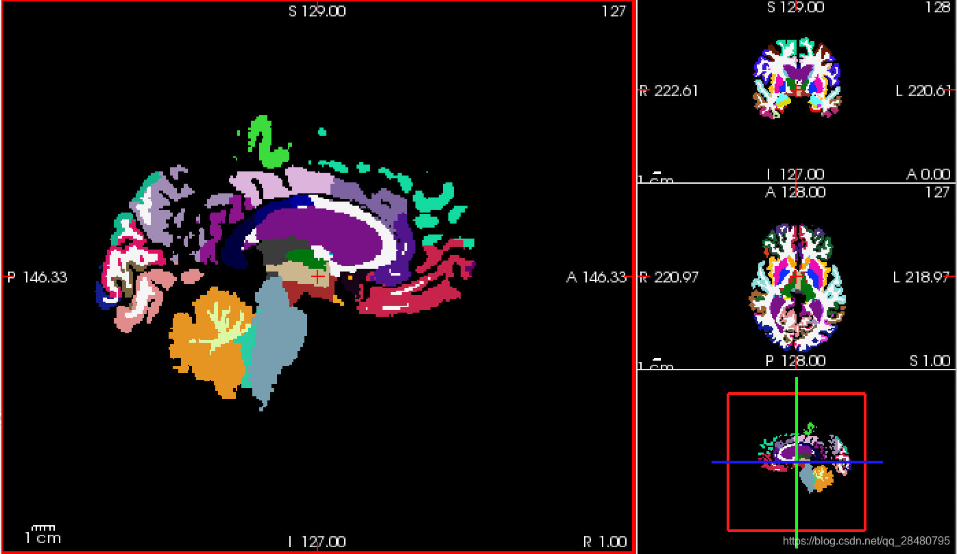 Freesurfer学习笔记——Introduction to Freesurfer Output(输出简介)-练习题_aparc和aseg ...