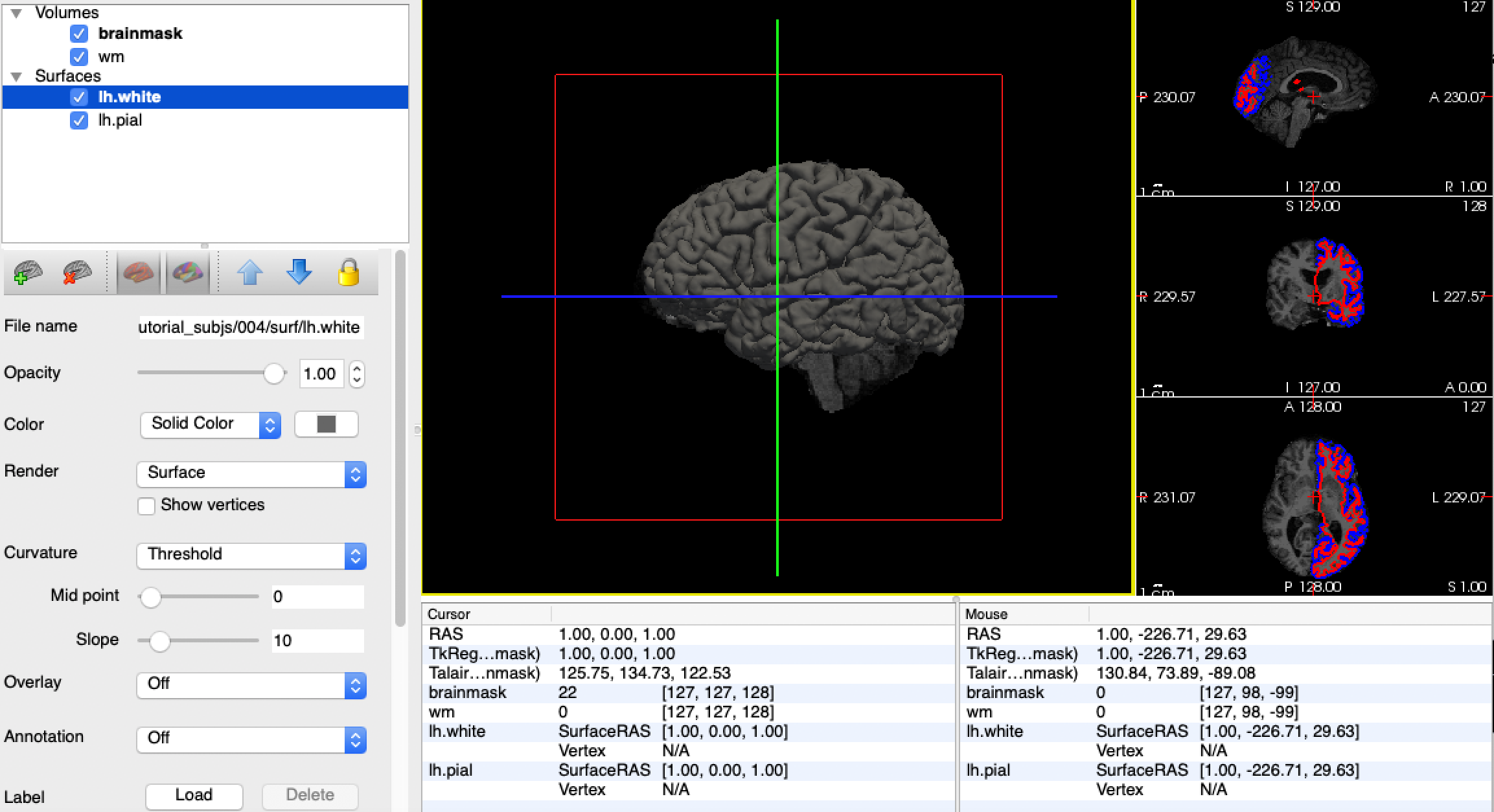 Freesurfer学习笔记——Introduction to Freesurfer Output(输出简介)-练习题_aparc和aseg ...