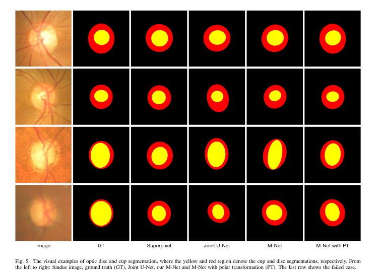 图像分割网络-M-Net_joint optic disc and cup segmentation based on mul-CSDN博客