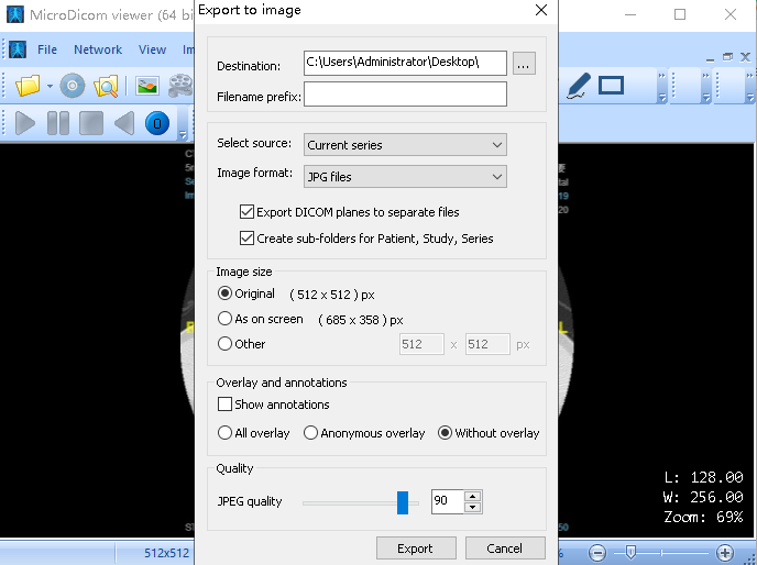 MicroDicom viewer：CT医学影像格式转换工具_microdicom怎么转一系列dicom文件-CSDN博客