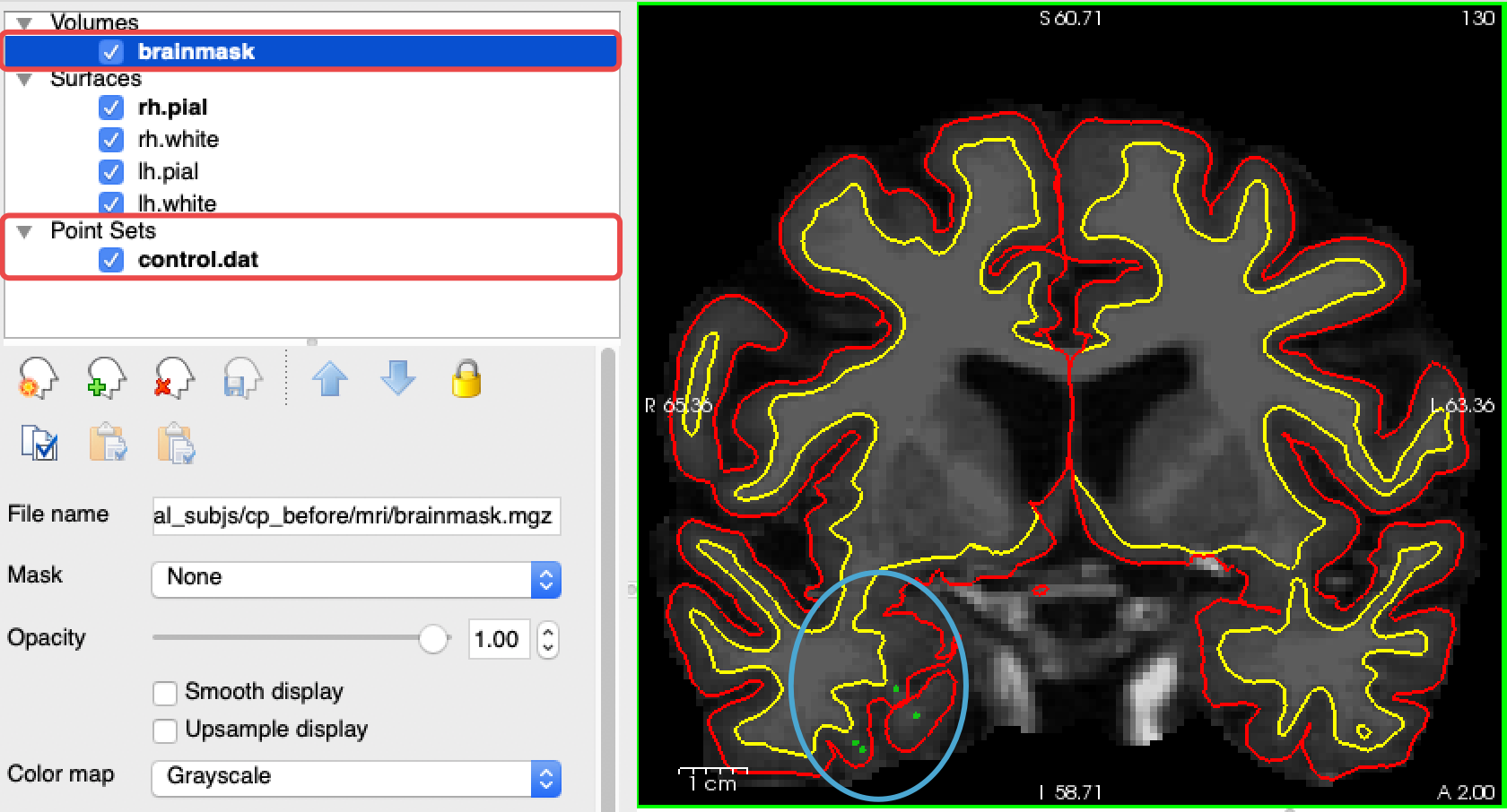Freesurfer学习笔记——Using Control Points to Fix Intensity Normalization3.5 ...