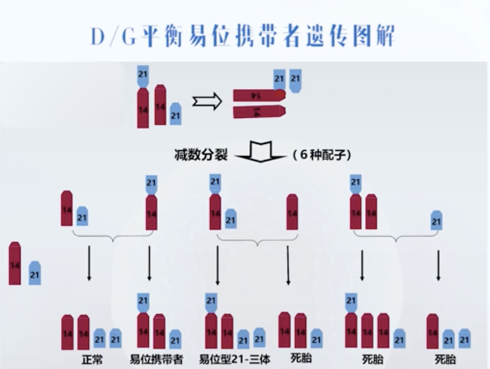 罗伯逊易位图片