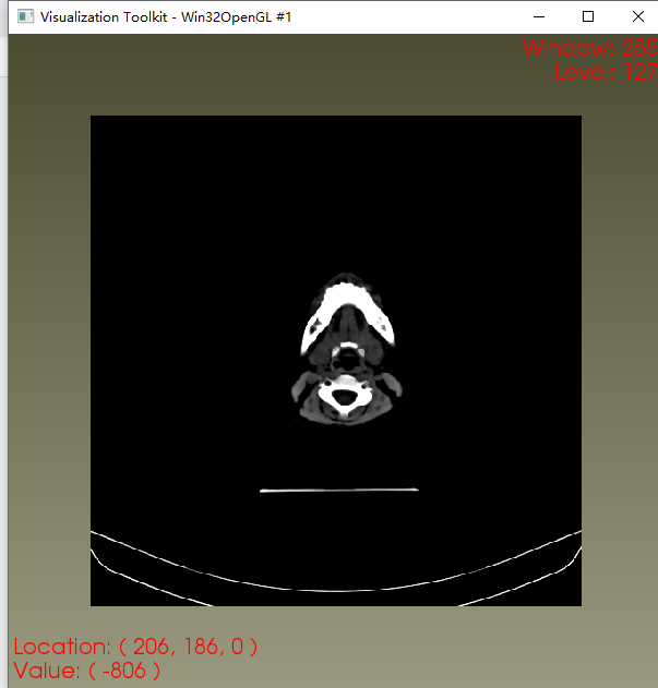【VTK】读取一张dicom—计算窗宽窗位并动态交互显示像素位置和像素值