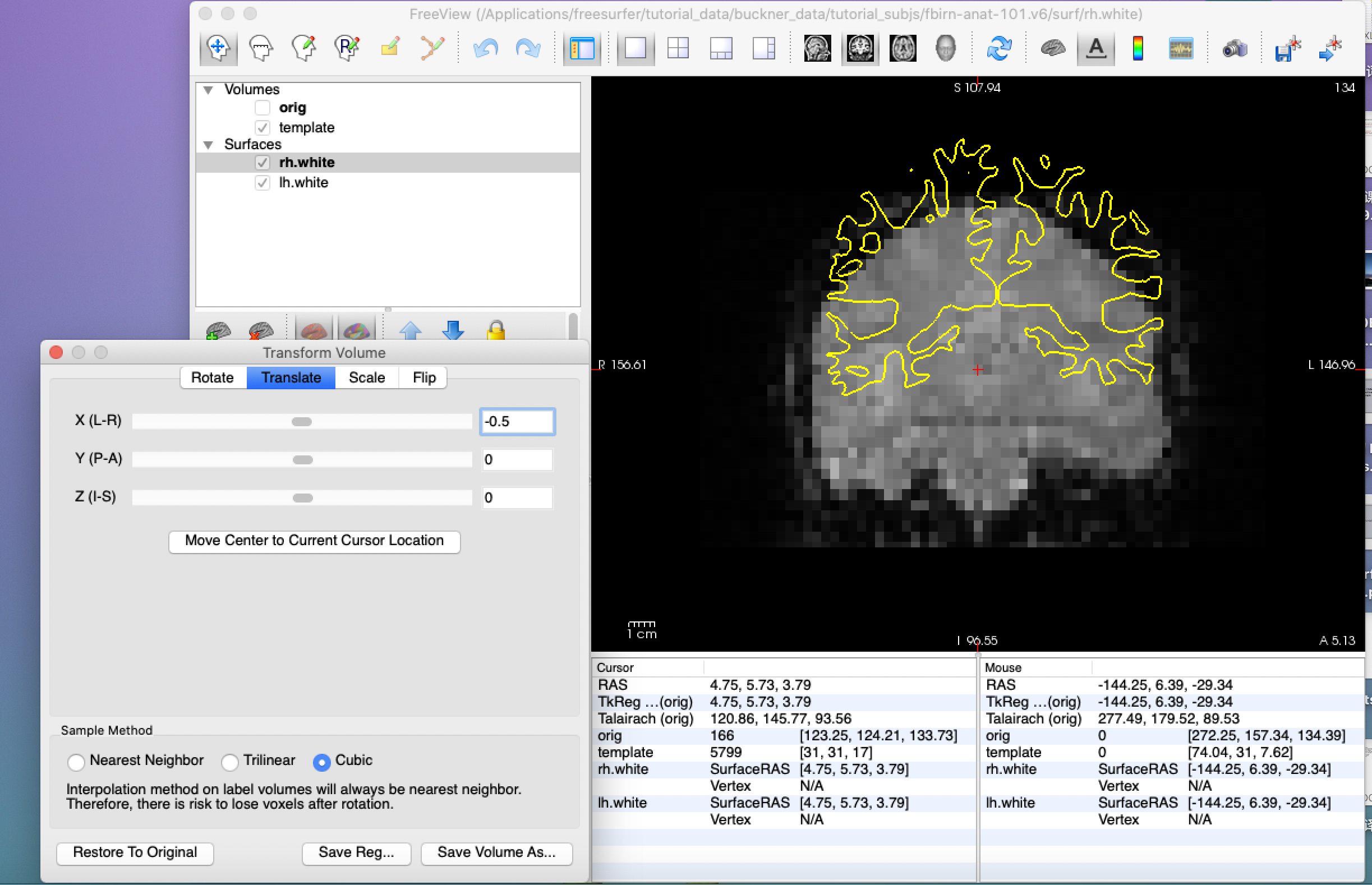 Freesurfer学习笔记——Multimodal Integration(1.Multimodal Registration ) 8/13 ...