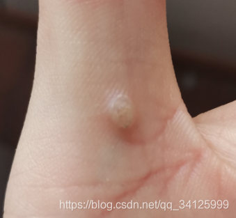 【某为】【OD】亲身45天吐血经历!!!!!!javaqq34125999的博客-