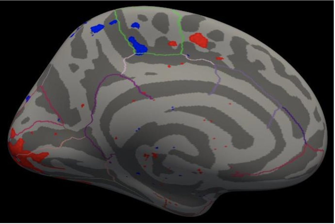 Freesurfer学习笔记——Multimodal Integration(2.2 Surface-based Group fMRI Analysis ) 8/13