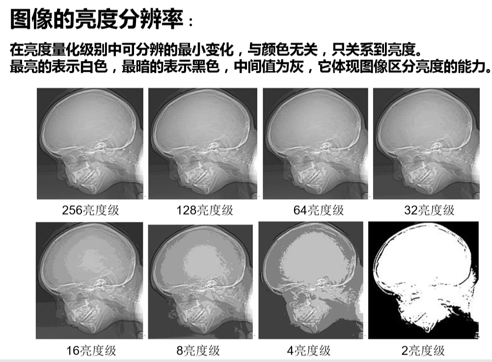 医学图像处理基本流程概念_医学影像图像处理过程包括哪些-CSDN博客