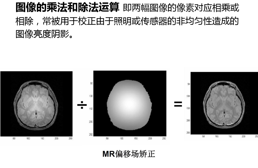 医学图像处理基本流程概念_医学影像图像处理过程包括哪些-CSDN博客