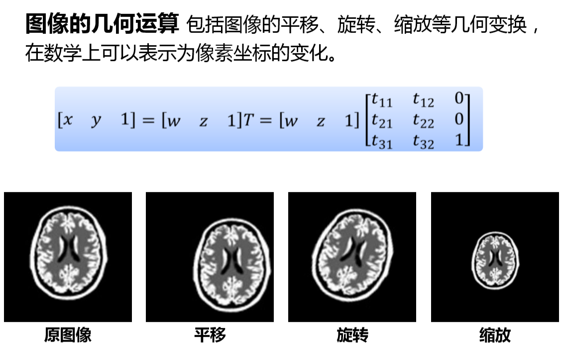 医学图像处理基本流程概念_医学影像图像处理过程包括哪些-CSDN博客
