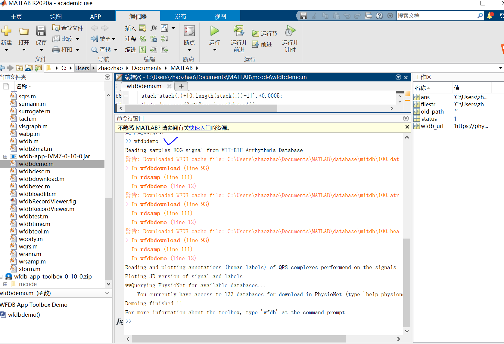 PhysioNet生理信号处理（三）--WFDB Toolbox For Matlab_physionet数据库p_signal和d ...