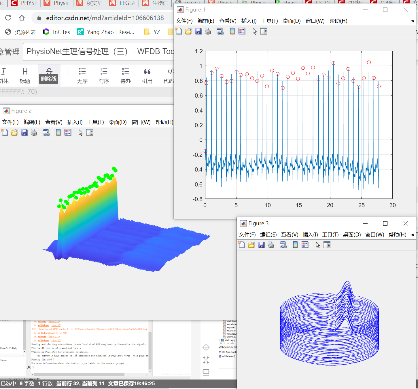 PhysioNet生理信号处理（三）--WFDB Toolbox For Matlab_physionet数据库p_signal和d ...