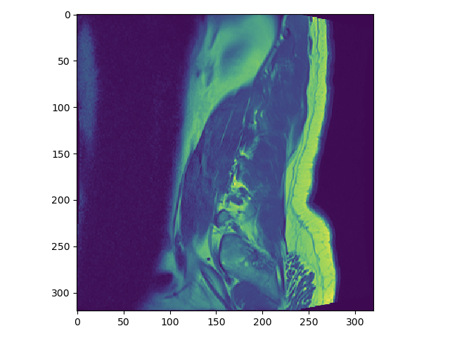 how-to-open-the-medical-image-in-the-ima-file-format-in-python-have