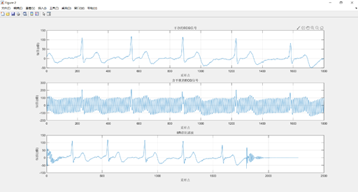 数字信号处理实验5:IIR和FIR滤波器过滤信号的实现及比较(以心电信号为例)weixin43586860的博客-