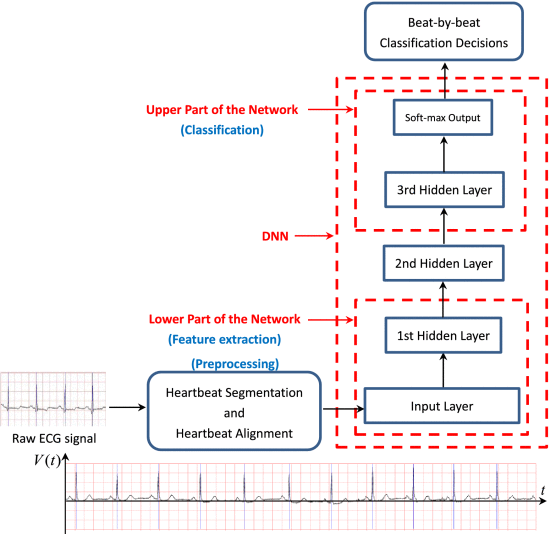 【论文阅读】Towards End-to-End ECG Classification With Raw Signal Extraction ...