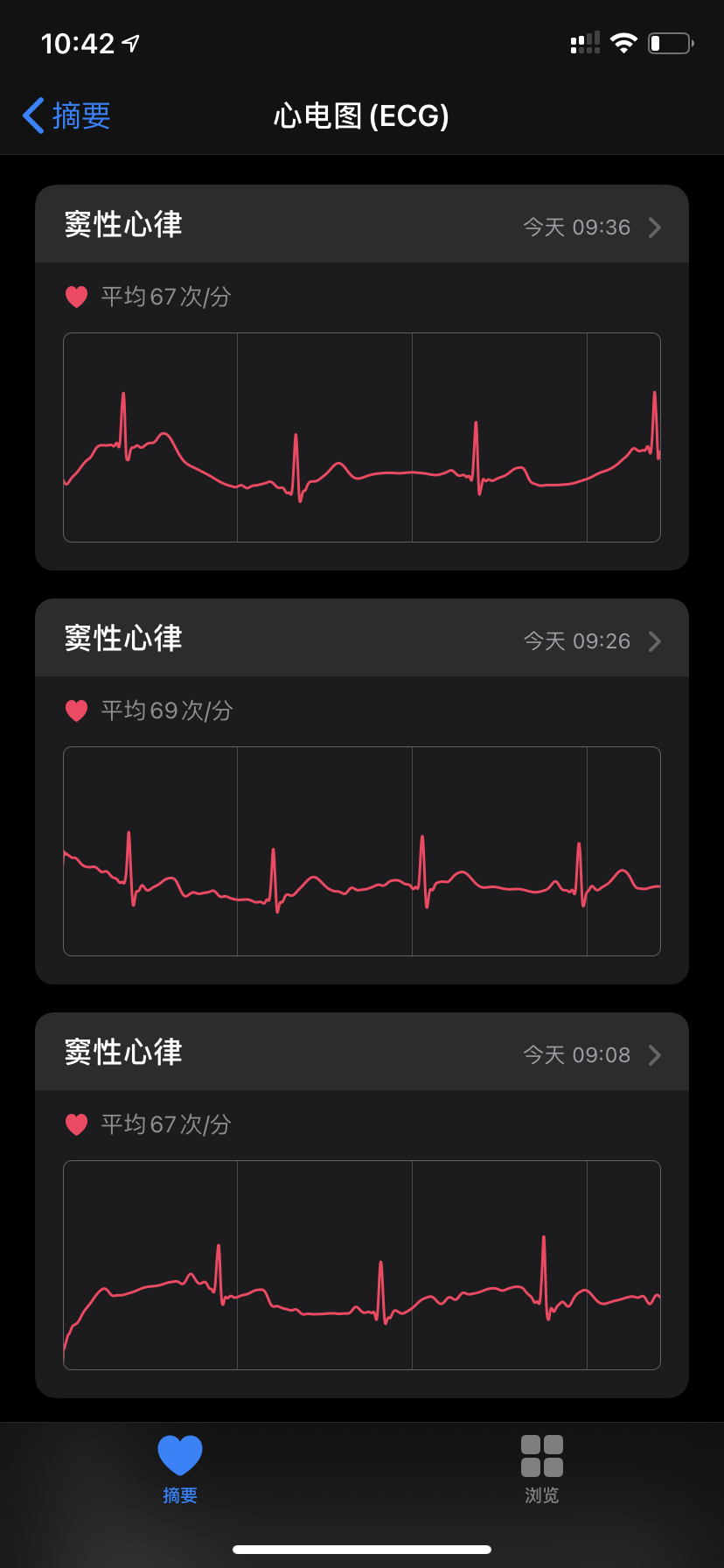 国行Apple Watch 开启 ECG 心电图功能