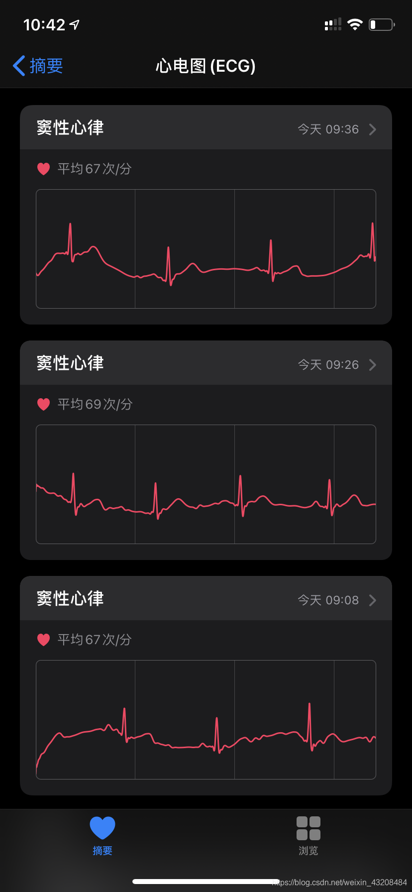国行Apple Watch 开启 ECG 心电图功能