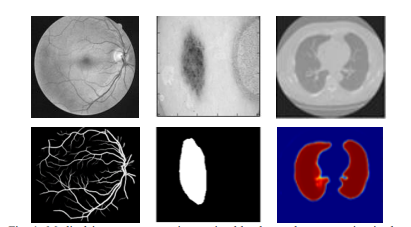 图1。医学图像分割：左侧为视网膜血管分割，右侧为皮肤癌病灶分割，右侧为肺部分割。