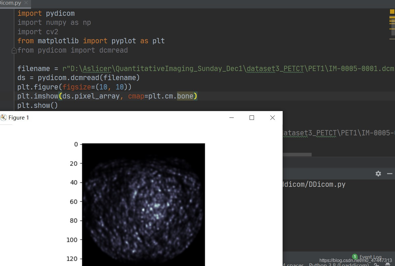 python3实现对dicom图像处理(图像呈现,缩放,平移)_pydicom scaleup-CSDN博客