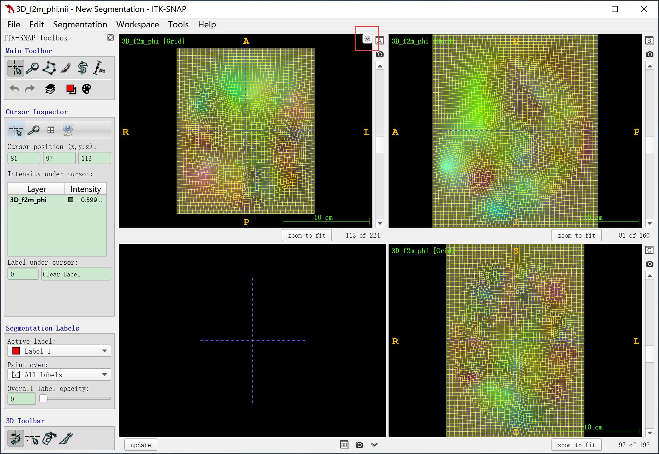 医学图像配准之形变场可视化(绘制形变场)-python黑洞网