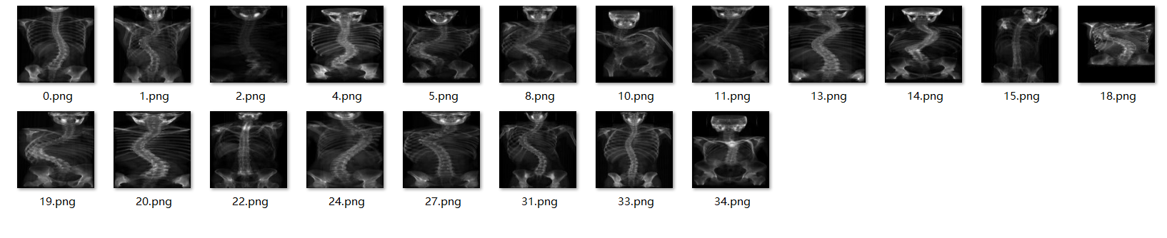 2D-X光图像重建3D-CT图像项目总结_医学图像2d序列生成3d模型-CSDN博客