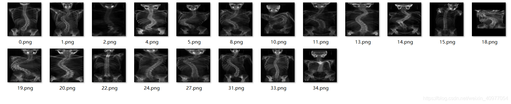 2D-X光图像重建3D-CT图像项目总结_医学图像2d序列生成3d模型-CSDN博客
