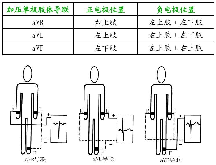 肢体导联和胸导联图片