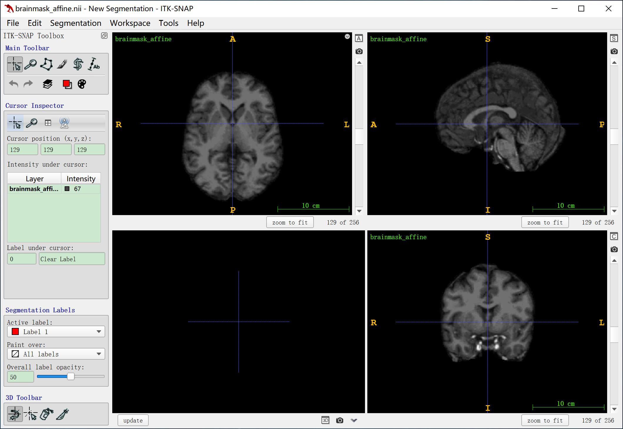 FreeSurfer和FSL的安装和使用（脑部图像去除头骨+对图像和label同时进行仿射对齐）教程