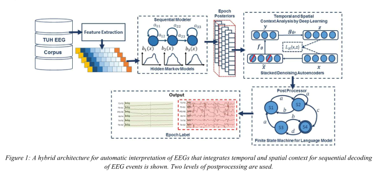 笔记-Deep Architectures for Automated Seizure Detection in Scalp EEGs