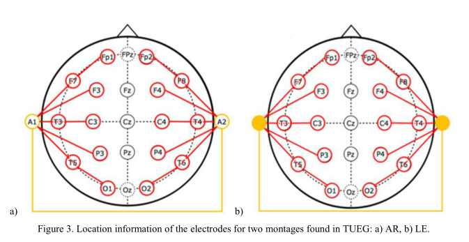 笔记 Thetemple University Hospital Eeg Corpus Electrodelocationand Channel Labels 人工智能 篮球方向 的博客 Csdn博客
